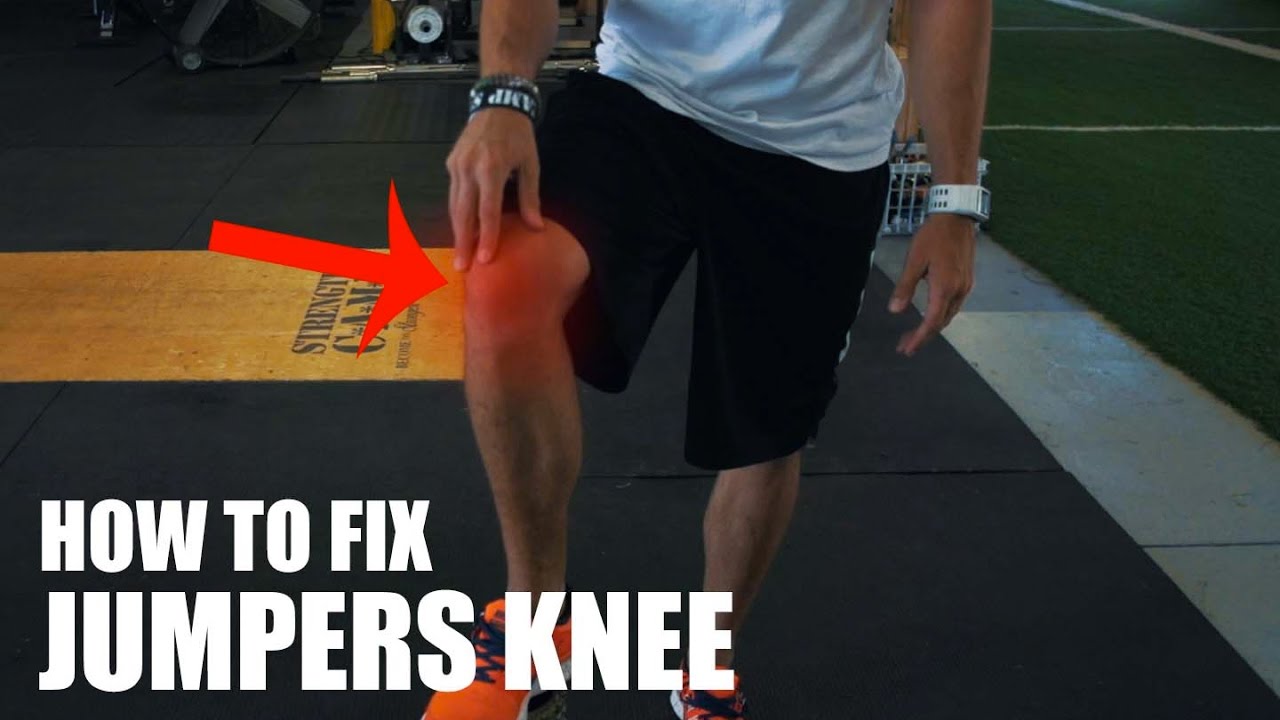 4 Steps to Fix Jumper’s Knee